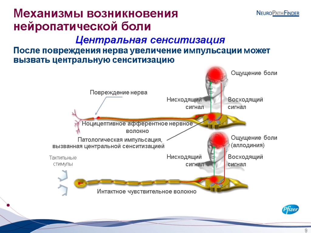 9 Механизмы возникновения нейропатической боли Центральная сенситизация Ощущение боли Восходящий сигнал Нисходящий сигнал Повреждение